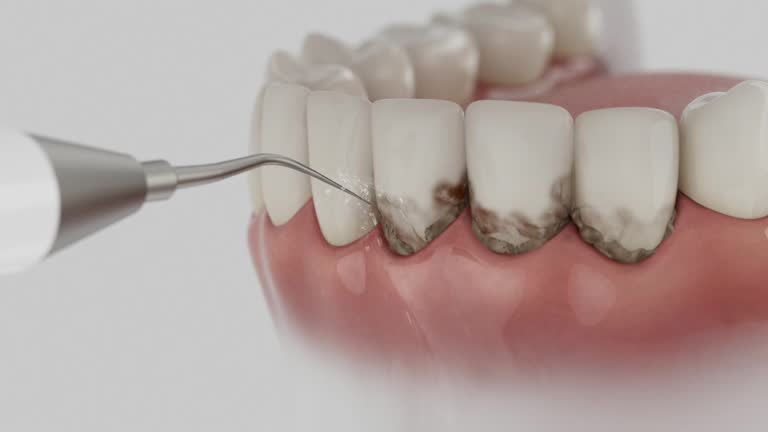 Trusted Emergency Dentist service in North Lewisburg, OH - Dentist Open Now